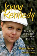 Watch The Boy Whose Skin Fell Off Primewire