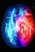 Watch Brain on Fire Primewire