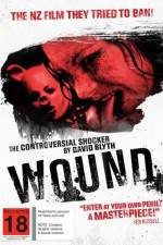 Watch Wound Primewire