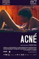 Watch Acné Primewire