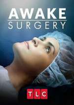 Watch Awake Surgery Primewire